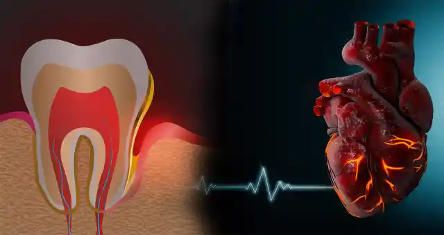 17. Gum Health Affects Your Heart
