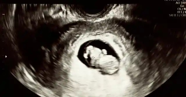 The Impossible Truth