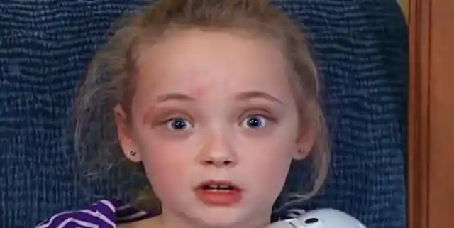 Girl Darts Out Of McDonald's Bathroom, Mom Looks Closely At Leg And Sees Why