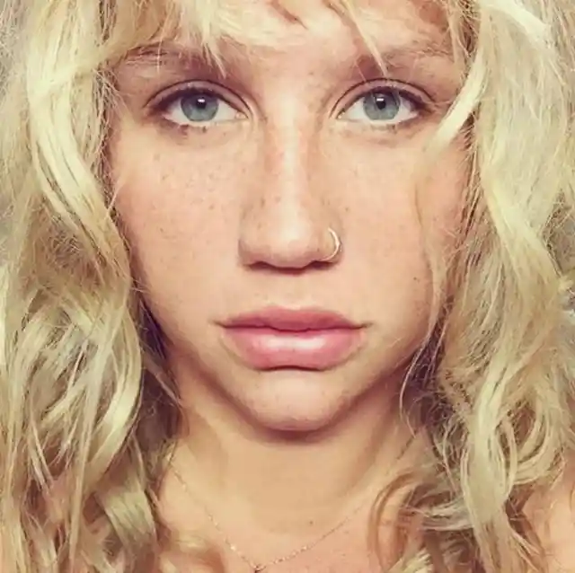 Kesha