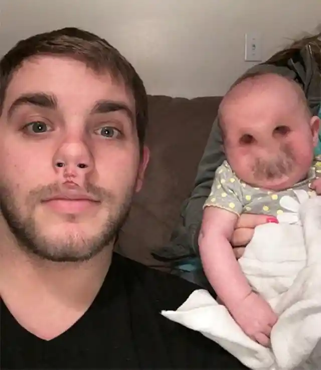 Face Swap Gone Awry