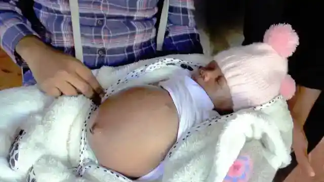 Swelling Stomach