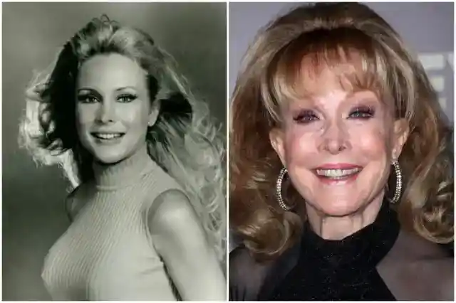 Barbara Eden – Cosmetic Surgery