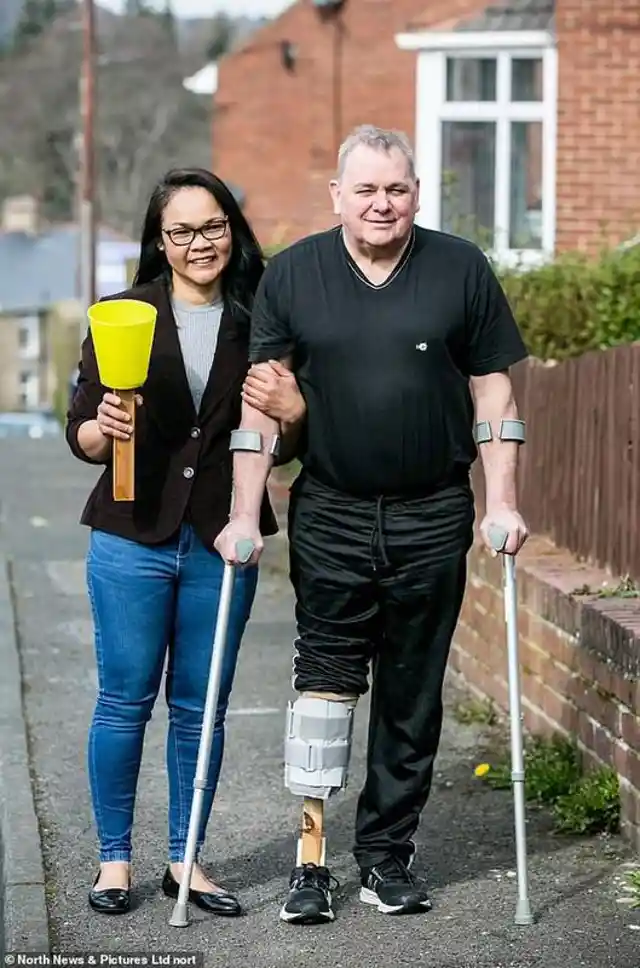 Woman creates DIY Prosthetic Leg For Husband Amid COVID-19 Delays