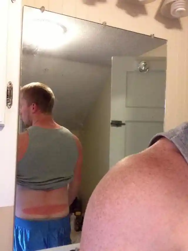 Sunburn Chooses No Spot