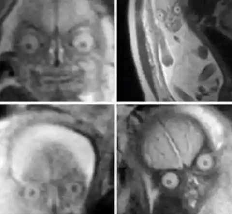 A Scary MRI