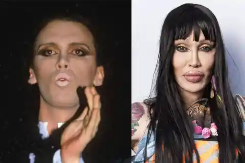 Pete Burns – $38,000