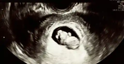 The Impossible Truth