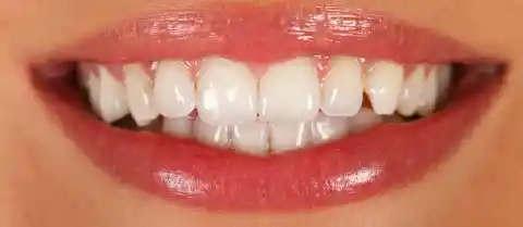 1. Your Enamel is Tougher Than Bone