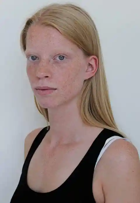 Stunning Freckles of Lotte Zuidema