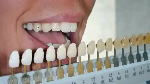 27. Your Teeth Aren’t Supposed to Be Perfectly White