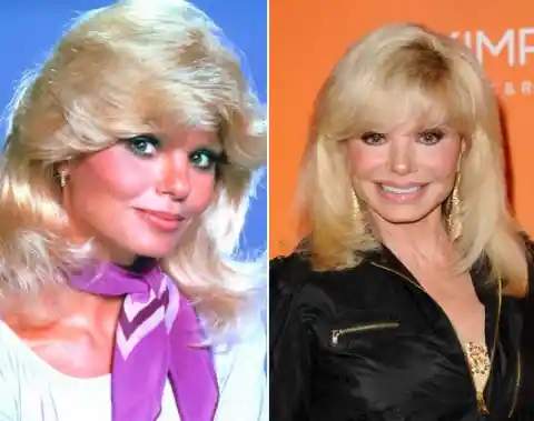 Loni Anderson