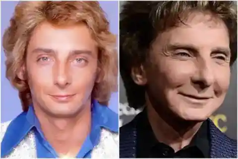 Barry Manilow – Rumored Cosmetic Surgery