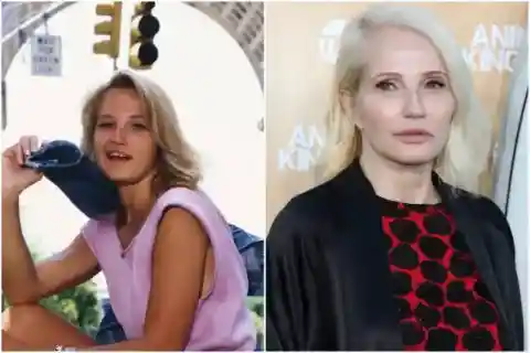 Ellen Barkin – Botox and Fillers