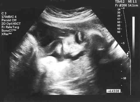 16. Dental Care Starts Before Birth