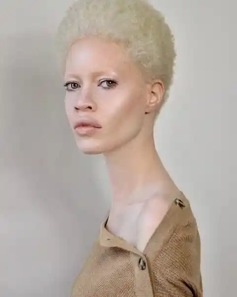 Albino Beauty of Diandra Forrest