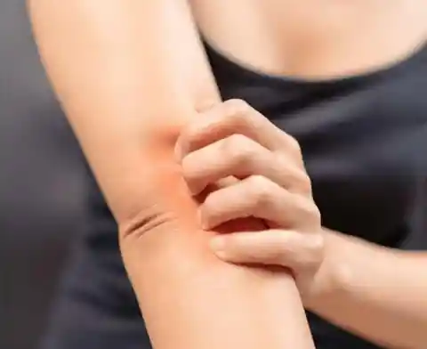 Relieve itchy skin