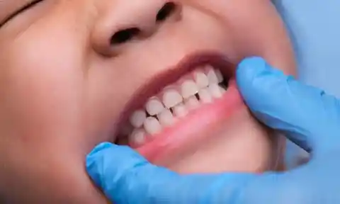 28. Baby Teeth Matter More Than You Think