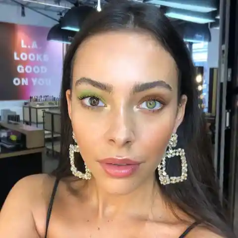 Heterochromia of Sarai Lewis