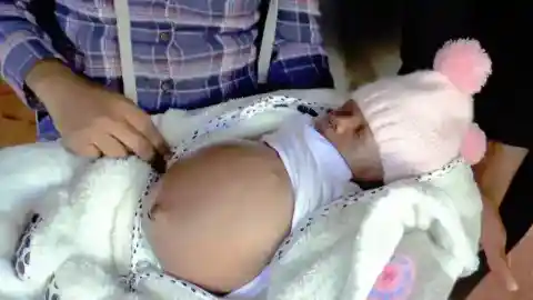 Swelling Stomach