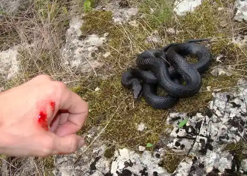 In an Emergency, Suck the Poison Out of a Snakebite