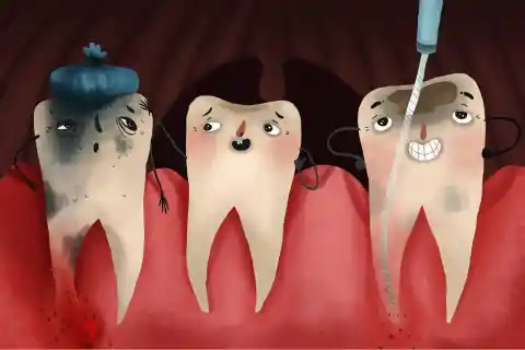 20. You Can Get Cavities In Your Roots