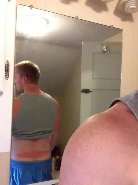 Sunburn Chooses No Spot