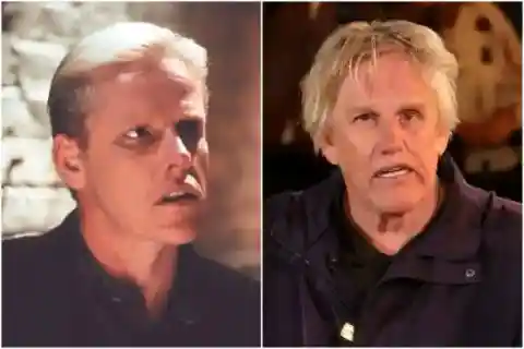 Gary Busey – Head Injury